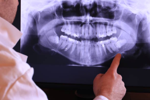 Best Chipped Tooth Repair Near Me  in Rolling Meadows, IL